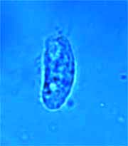 Cyclidium sp.